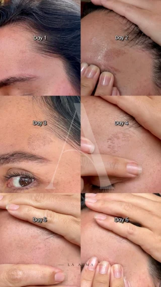 Instagram post from laalma_co. This post is in position 2.